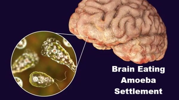 Brain Eating Amoeba Settlement